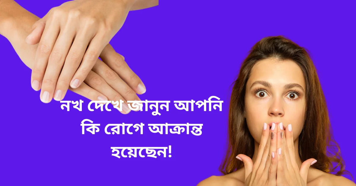 নখ দেখে জানুন আপনি কি রোগে আক্রান্ত হয়েছেন!